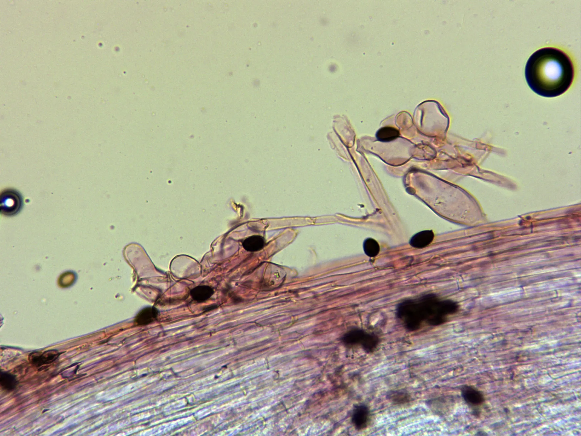 Microscopía de Psathyrella bipellis - 10 - Caulocistidios alto pié x 400